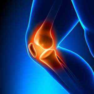 Пателлофеморальний артроз (синдром) колінного суглоба 123 ступеня: лікування | Ревматолог