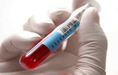 Підготовка чоловіків до здачі аналізу крові на ПСА