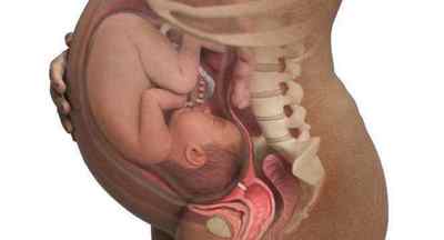 Підковоподібна нирка у дитини: причини і лікування