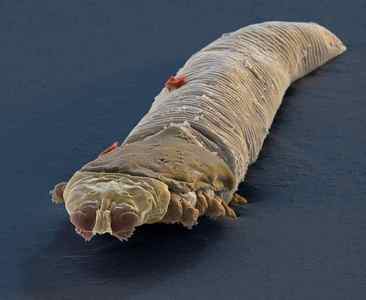 Підшкірні паразити у людини: симптоми, фото глистів і червяків під шкірою