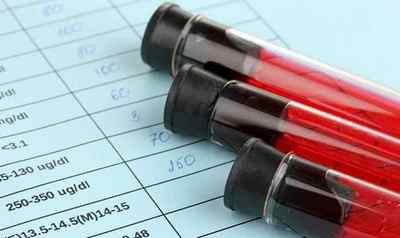 Підвищений гемоглобін у чоловіків: причини, лікування і наслідки