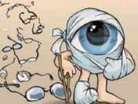 Підвищений очний тиск: симптоми і лікування, ознаки, причини, що робити