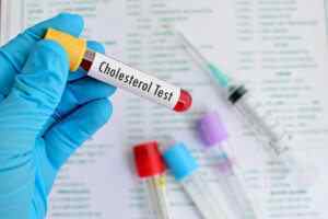 Підвищено холестерин: причини, симптоми, що робити