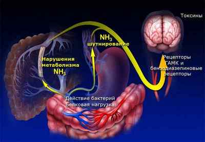 Печінкова енцефалопатія: суть і ознаки патології, лікування
