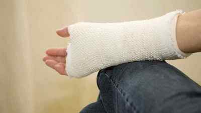 Перелом кисті руки: симптоми і лікування, скільки днів носити гіпс і як розробити кисть руки після перелому, фото | Ревматолог