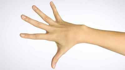 Перелом кисті руки: симптоми і лікування, скільки днів носити гіпс і як розробити кисть руки після перелому, фото | Ревматолог