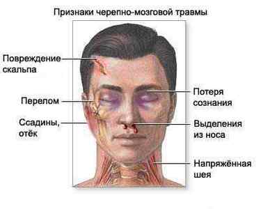 Перелом кісток черепа: види, симптоми, лікування і наслідки