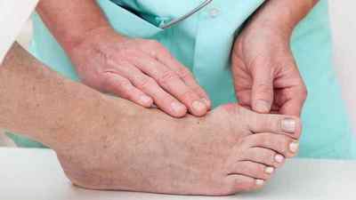 Перелом великого пальця ноги: симптоми і лікування без гіпсу, як відрізнити перелом від удару, фото і ознаки | Ревматолог