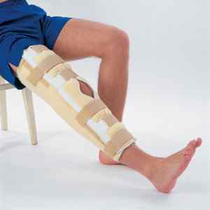 Переломи кісток гомілки: як розробляти ногу і перша допомога, реабілітація та відновлення, симптоми і накладення шини | Ревматолог