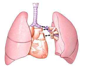 Пересадка легенів (трансплантація): показання, хід, прогноз
