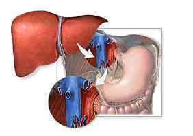 Пересадка (трансплантація) печінки: показання, ціна, хід