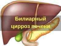 Первинний біліарний цироз печінки: симптоми, лікування, діагностика