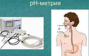 pH-метрія шлунка: підготовка і проведення дослідження