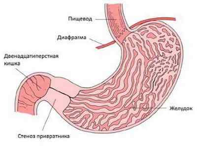 Пилорический відділ шлунка: які функції виконує, хвороби і їх лікування