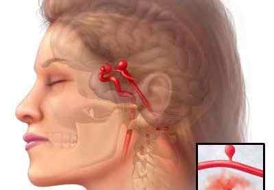 Писк в вухах і голові: причини і лікування