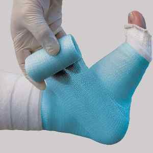 Пластиковий гіпс: заміна гіпсу на полімерний медичний, як зняти в домашніх умовах полімерні лангети з ноги або руки | Ревматолог