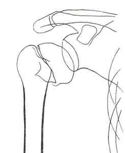 Плечова кістка - анатомія і пошкодження