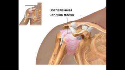 Плечовий суглоб: будова і анатомія у людини, сумки і мязи плечового суглоба, якими кістками утворений плечовий суглоб | Ревматолог