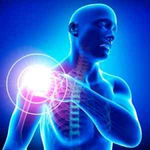 Плексопатія плечового сплетення: лікування і симптоми, МКБ 10 і вправи, що таке плечова плексопатия | Ревматолог