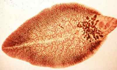 Плоскі глисти: особливості плоских хробаків паразитів у людини