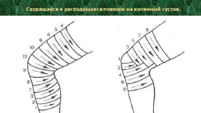 Повязки на ліктьовий суглоб: накладення первинної черепашачою повязки на колінний суглоб, налокітники та еластичний фіксатор | Ревматолог