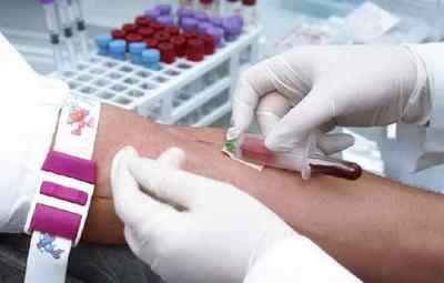 Правила підготовки до біохімічного аналізу крові