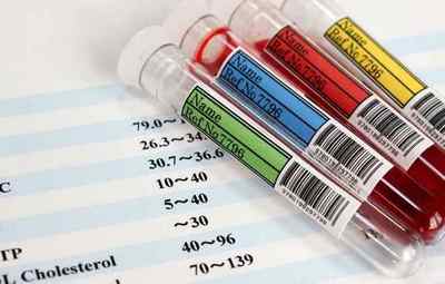 Правильні норми фосфору в аналізі крові