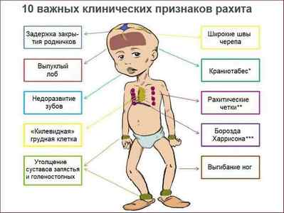 Правобічна пневмонія у дитини: симптоми, лікування