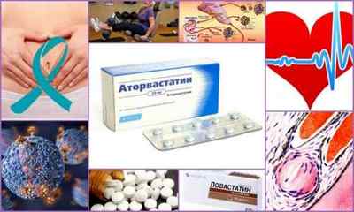 Препарати для лікування атеросклероз судин нижніх кінцівок: типи засобів, опис