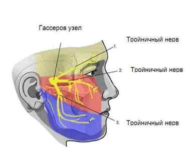 Причини і лікування периферичного парезу лицьового нерва