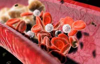 Причини підвищення тромбоцитів в крові дорослої людини