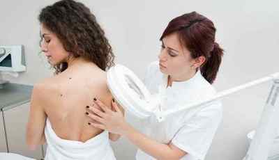 Причини та ефективне лікування бородавок на спині