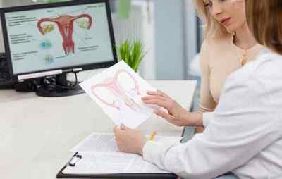Причини і види ендометріозу