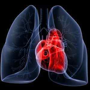 Прикореневій пневмосклероз легенів: що це таке і як його лікувати