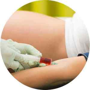 Профілактика цукрового діабету вагітних і дієтотерапія