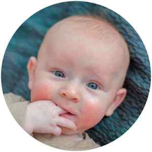 Профілактика і лікування дерматиту у немовлят