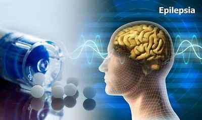 Психомоторна епілепсія: причини, симптоми і лікування