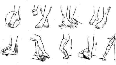 Після зняття гіпсу з ноги боляче ходити: що робити далі і чим мазати, як почати ходити і реабілітація | Ревматолог