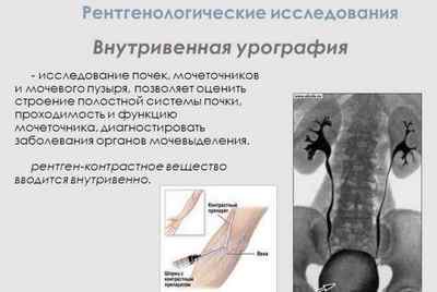 Рентгенографія нирок з контрастною речовиною: підготовка до дослідження