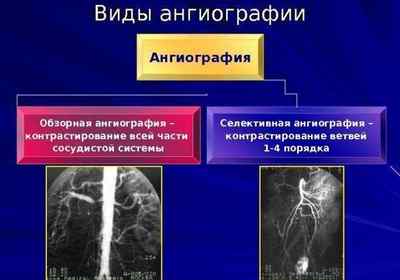 Рентгенографія нирок з контрастною речовиною: підготовка до дослідження