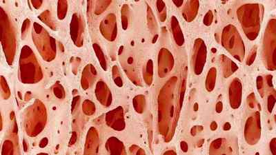 Резорбція кісткової тканини: що це таке в медицині, маркер резорбції кістки щелепи | Ревматолог