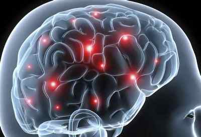 Ризики операції після інсульту головного мозку