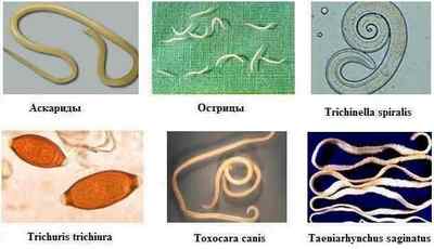 Ромашка від глистів та паразитів в організмі людини: відгуки про відвар