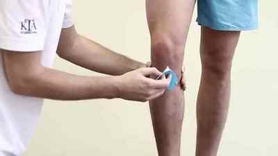 Розрив хрестоподібних звязок коліна: частковий розрив передньої хрестоподібної звязки (ПКС) і лікування без операції, фото | Ревматолог