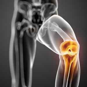Розрив менісків колінного суглоба: симптоми і лікування без операції, розрив заднього рогу медіального меніска, вправи | Ревматолог