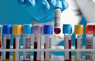 Розшифровка показників біохімічного аналізу крові
