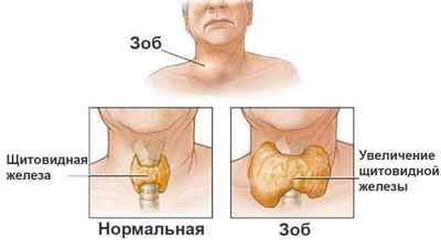 Щитовидна залоза: гормони і захворювання щитовидки