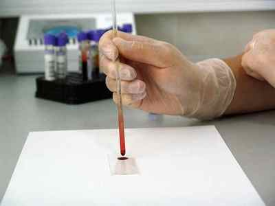 Що означає АСТ в біохімічному аналізі крові
