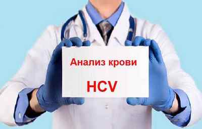 Що покаже аналіз крові HCV і як здавати