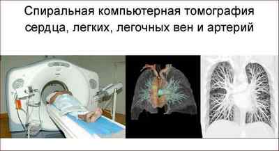 Що показує компютерна томографія легенів і як її роблять